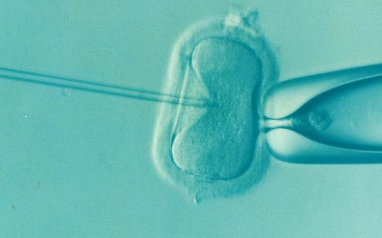 Needle shown being inserted into an ovum/egg cell under a microscope