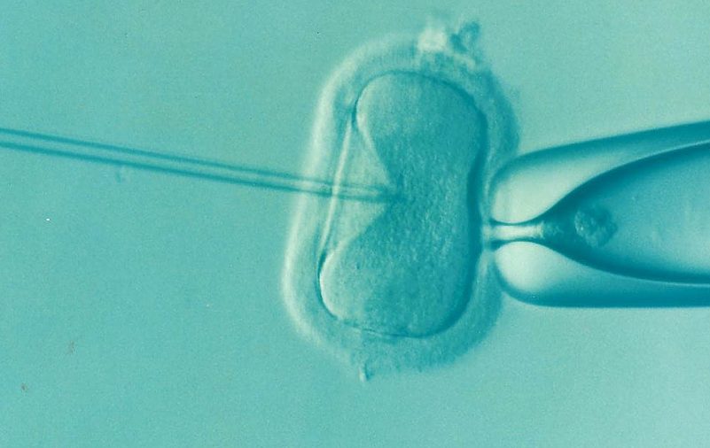 Needle shown being inserted into an ovum/egg cell under a microscope