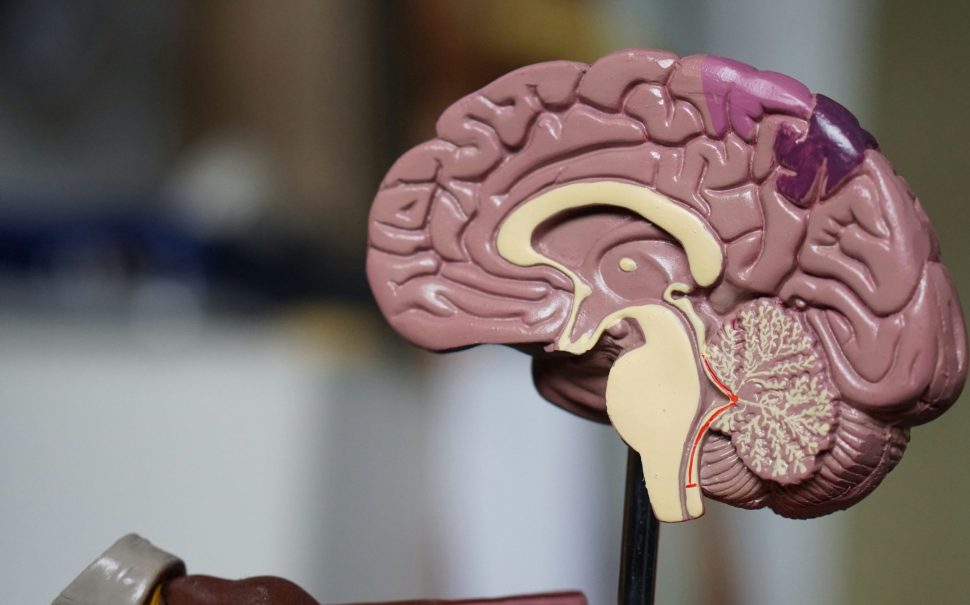 Cross Section of a brain