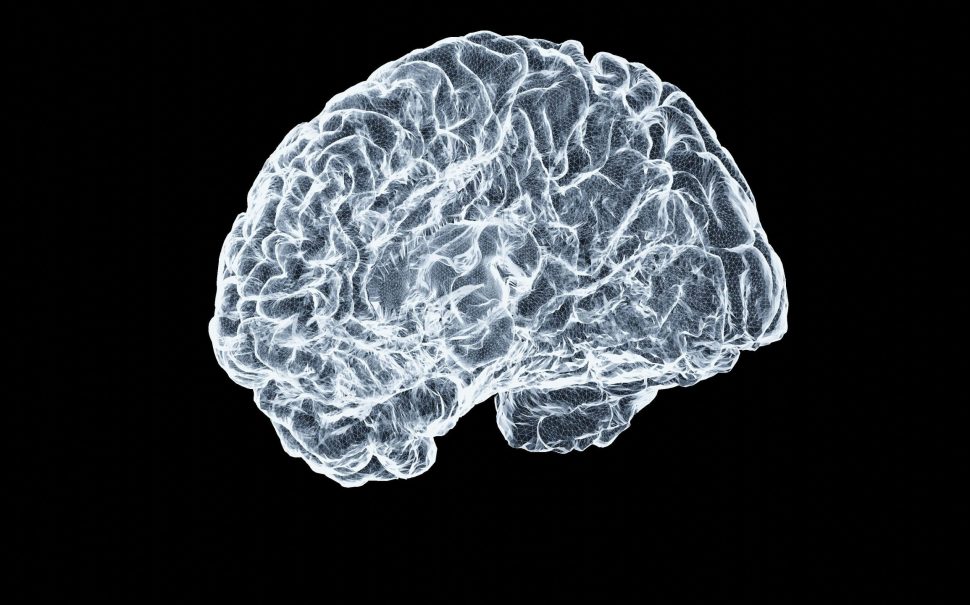 An image of a brain
